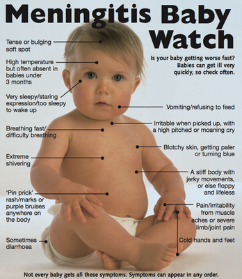 Meningitis Baby Watch